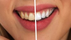 Jak mít bílé zuby